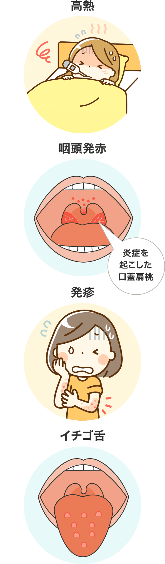 高熱/咽頭発赤/発疹/イチゴ舌