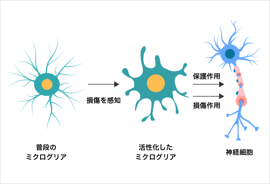 ミクログリアの活性化による「認知症予防」