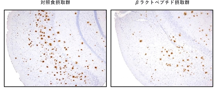 アルツハイマー病モデルの脳におけるアミロイドβの沈着