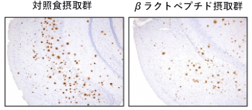 アルツハイマー病モデルの脳におけるアミロイドβの沈着